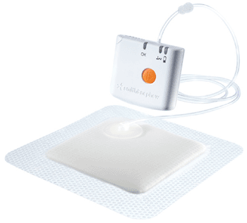 Image: The PICO negative pressure wound therapy system (Photo courtesy of Smith & Nephew).